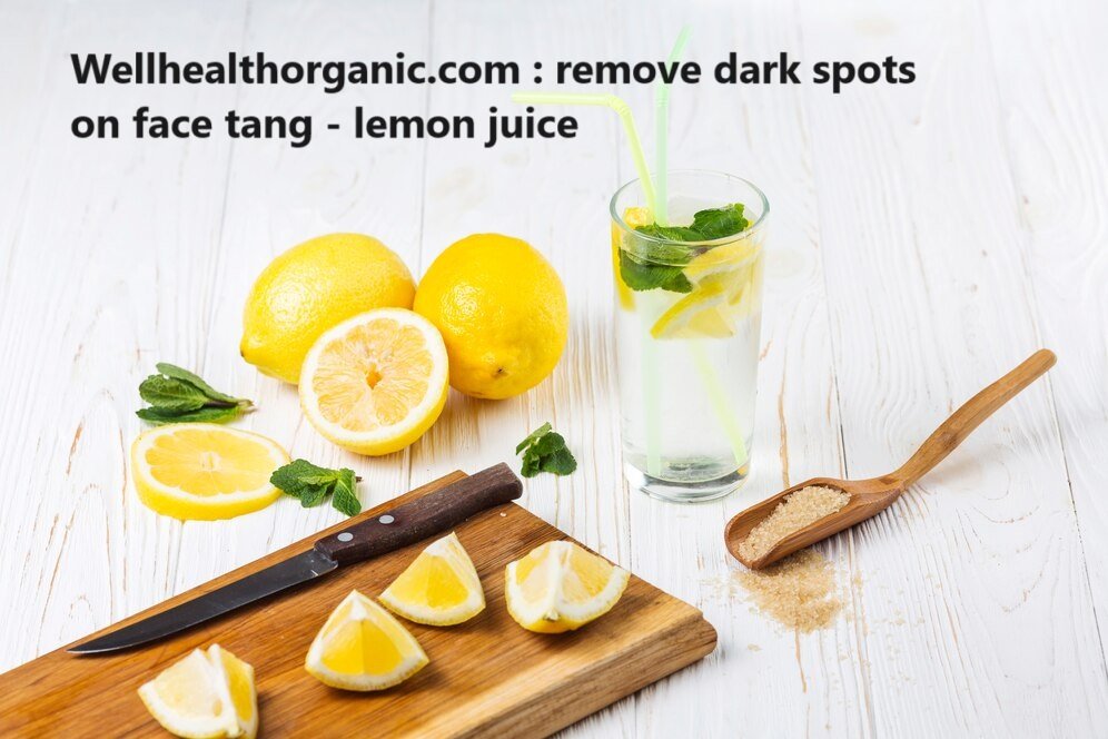 Wellhealthorganic.com : remove dark spots on face tang - lemon juice